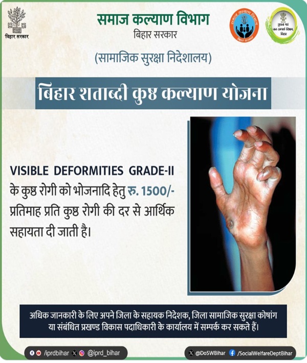 बिहार शताब्दी कुष्ठ कल्याण योजना